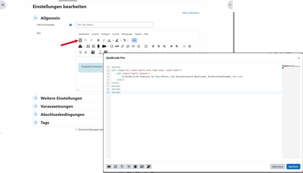 Screenshot: TinyMCE-Editor zeigt das Icon im Menü für die Quellcode Darstellung.